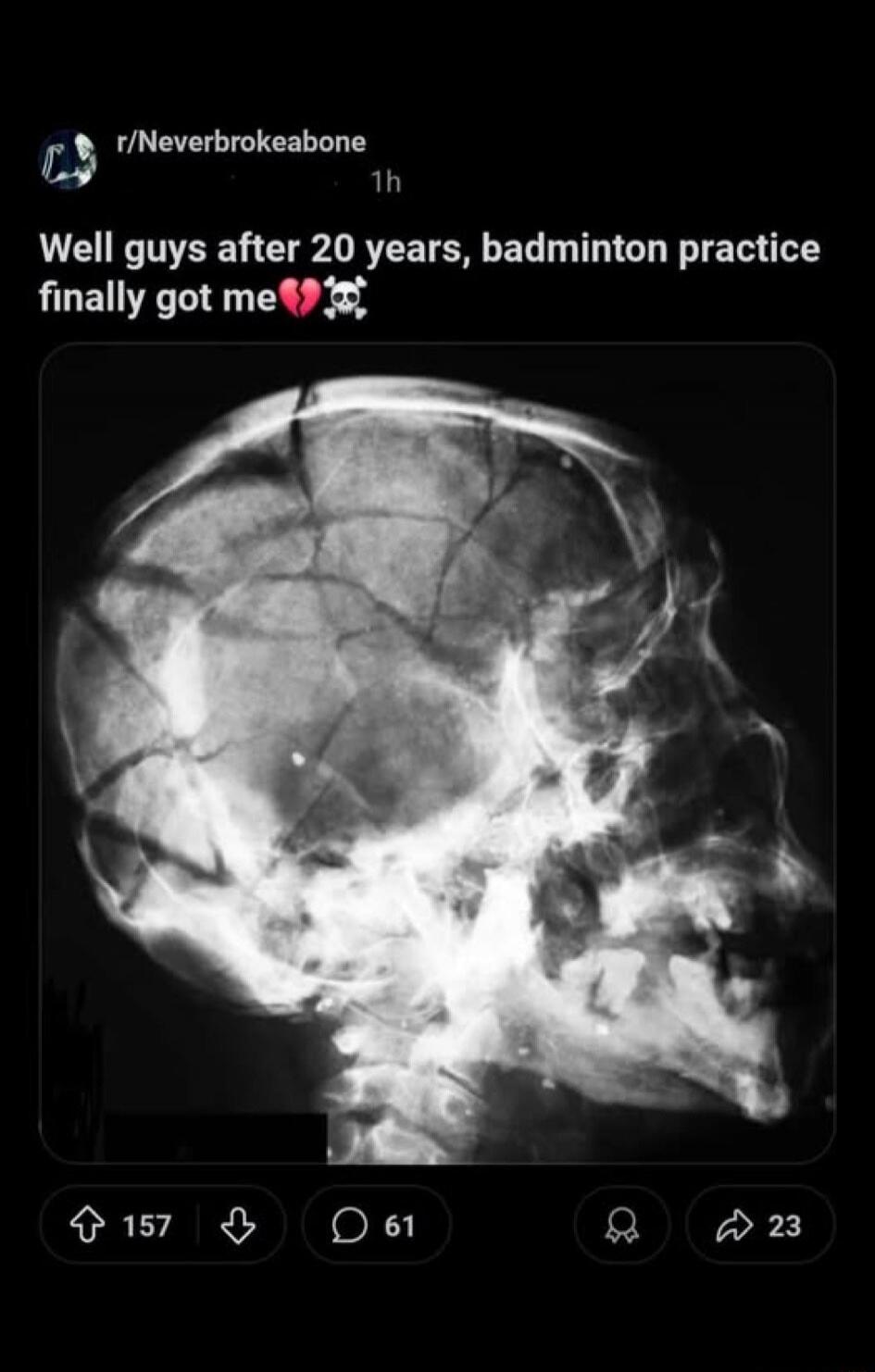 Well guys after 20 years, badminton practice finally got me💔💀