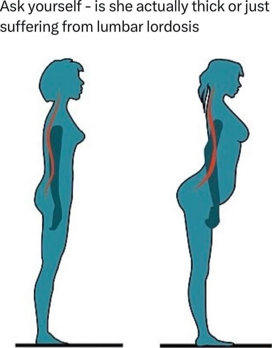 Ask yourself Is she actually thick or just suffering from lumbar lordosis