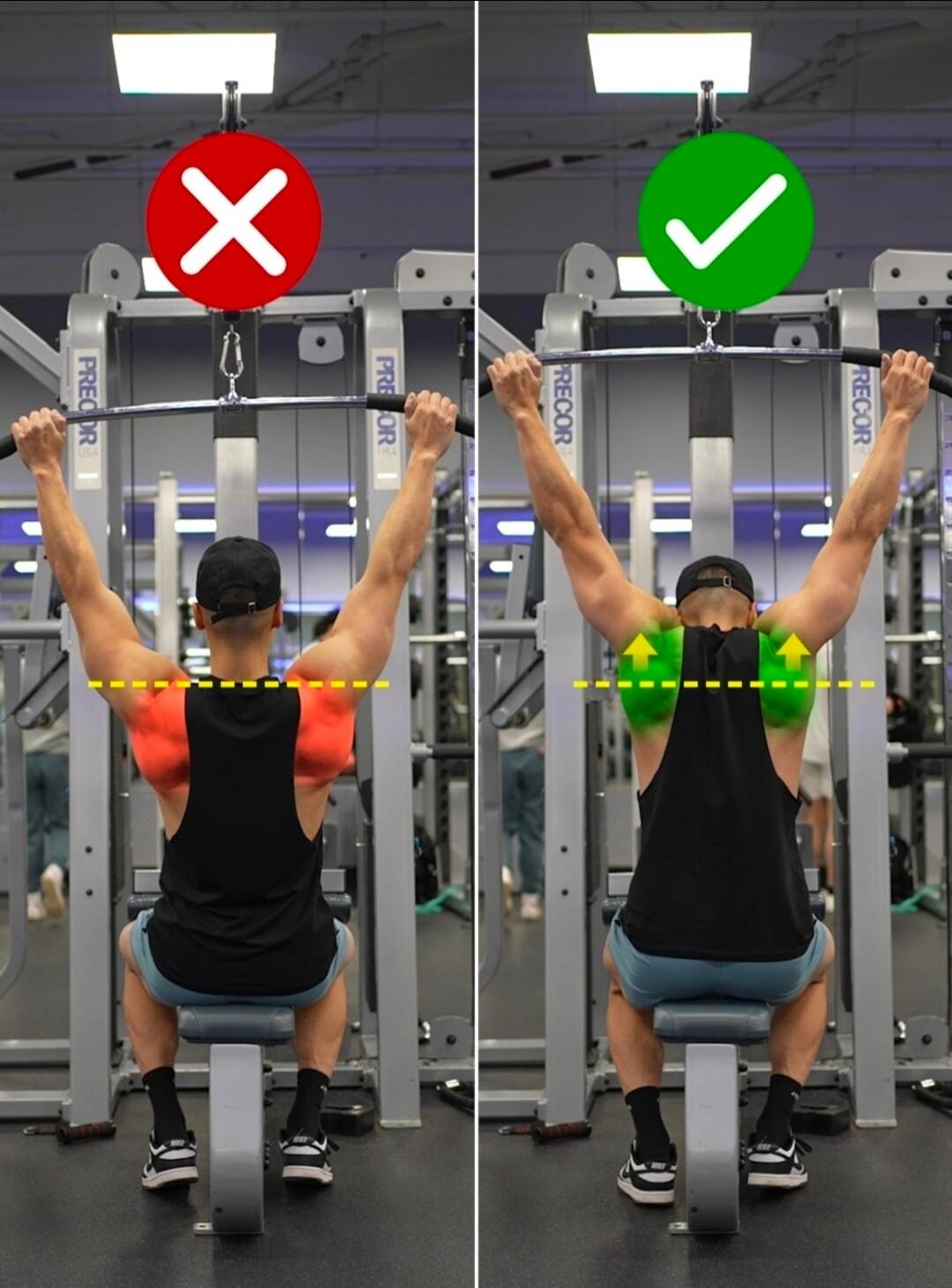 A visual guide demonstrating the correct and incorrect form for the lat pulldown exercise, specifically focusing on proper shoulder depression versus shrugging.
