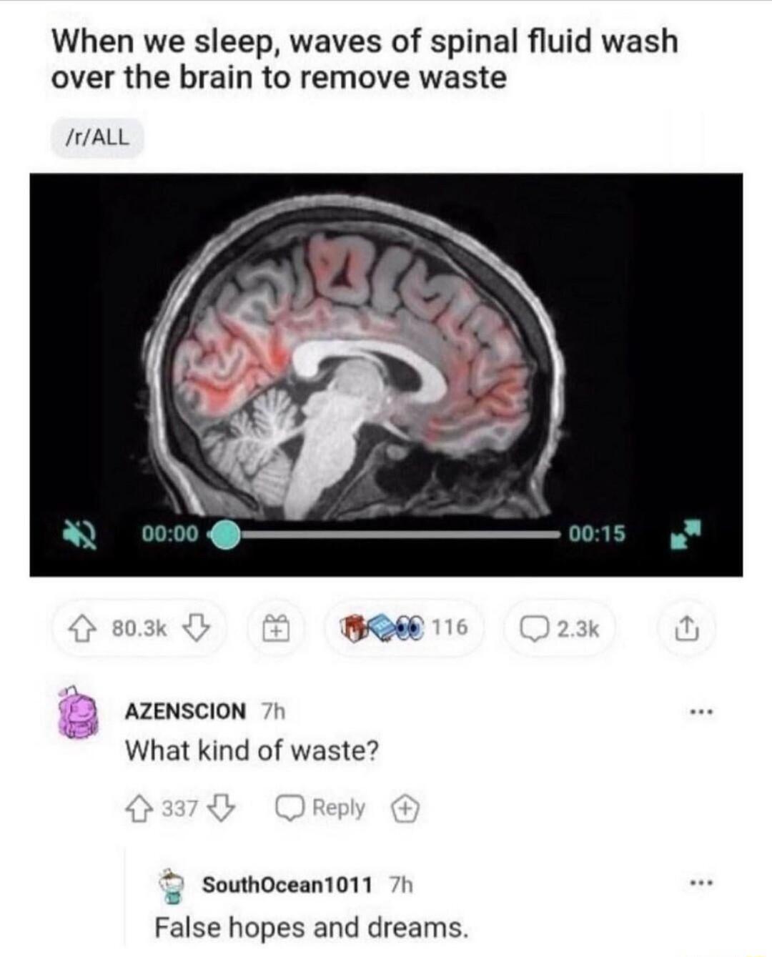 When we sleep waves of spinal fluid wash over the brain to remove waste JALL B AZENSCION What kind of waste 2 Southocean1011 7t False hopes and dreams