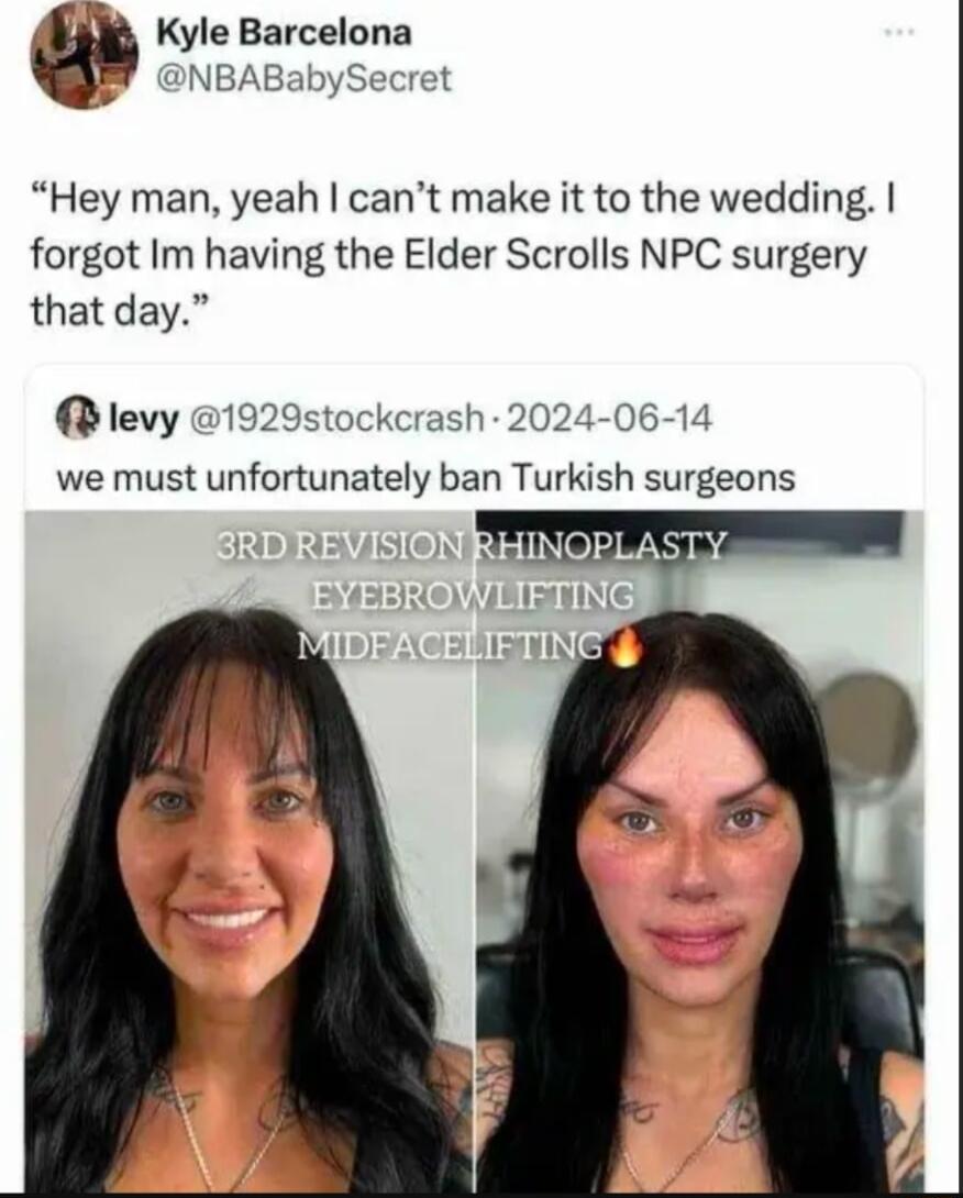 b Kyle Barcelona INBABabySecret Hey man yeah cant make it to the wedding forgot Im having the Elder Scrolls NPC surgery that day tockcrash 2024 06 14 levy we must unfortunately ban Turkish surgeons