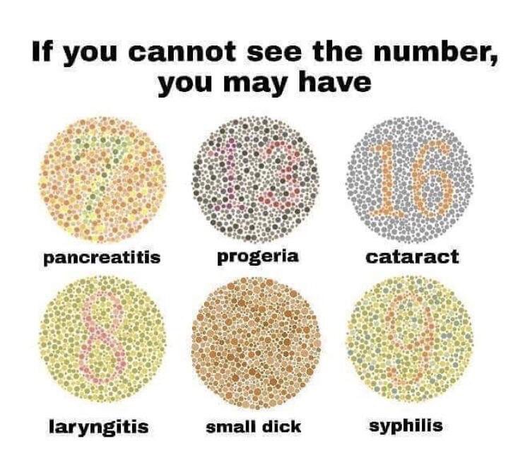 If you cannot see the number you may have ATiEs pancreatitis progeria cataract laryngitis small dick syphilis