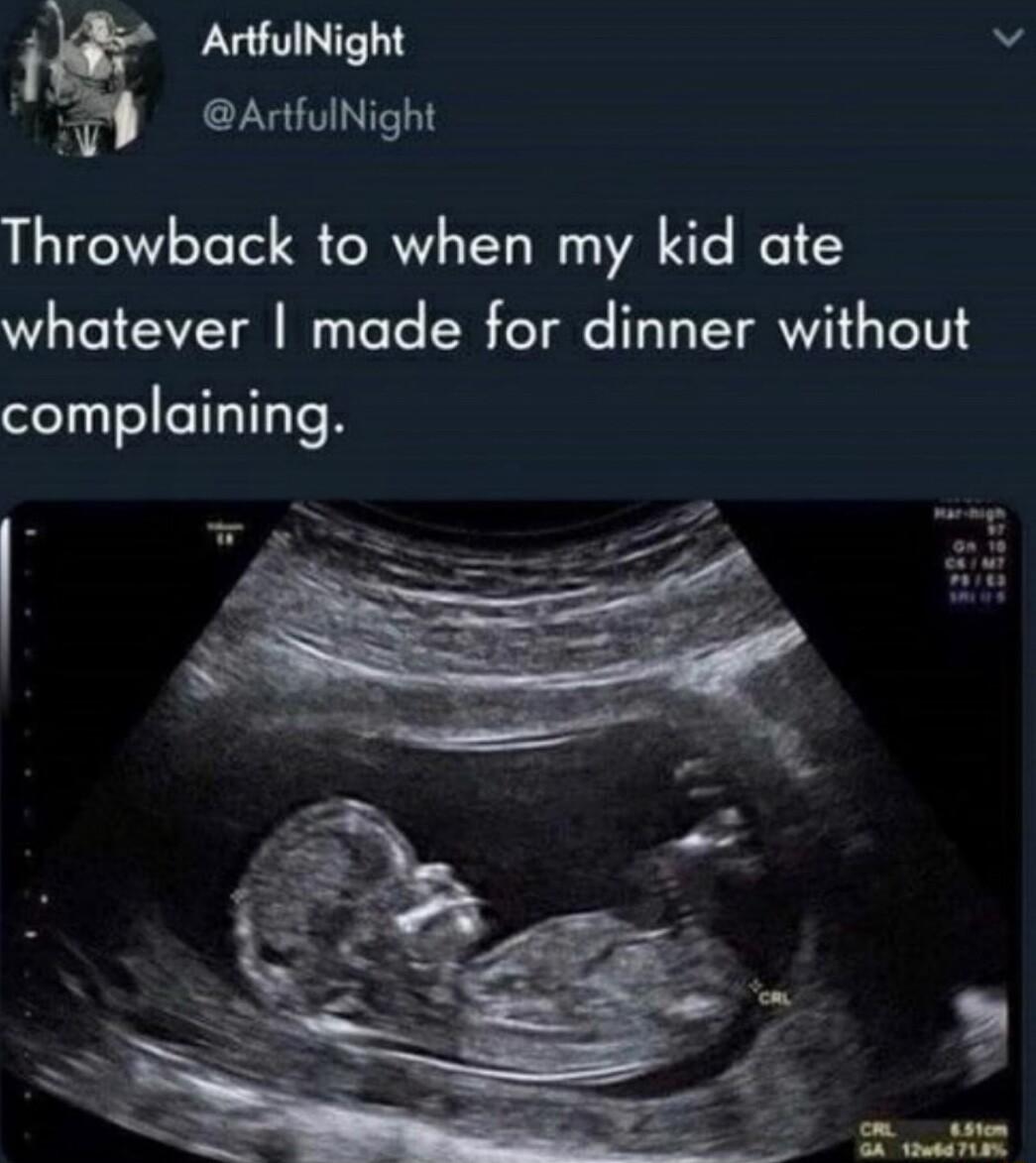 ArtfulNight v AtfulNight Throwback to when my kid ate whatever made for dinner without complaining