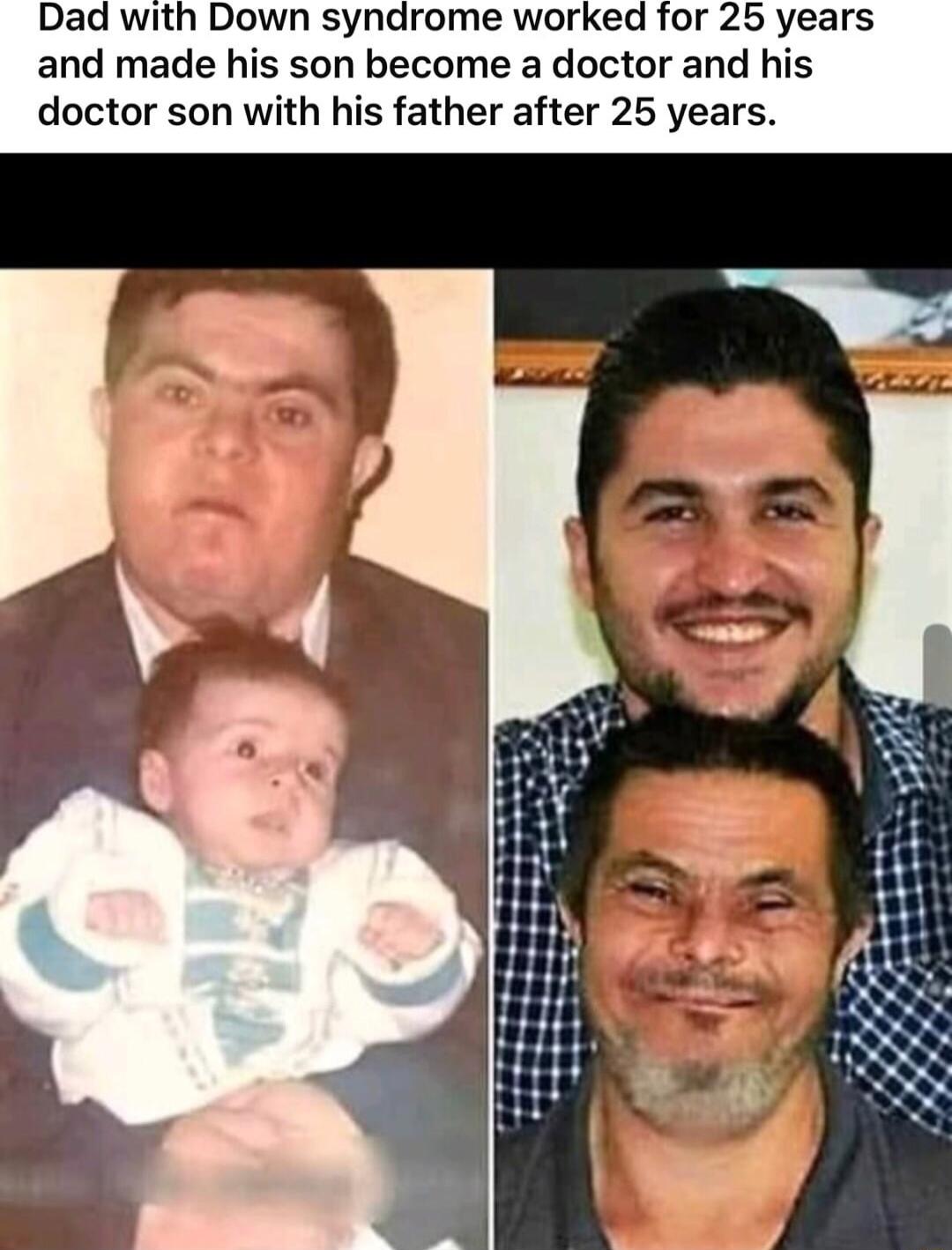 Down syndrome worked for 25 years and made his son become a doctor and his doctor son with his father after 25 years