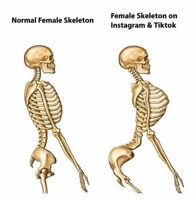 Normal Female Skeleton Female Skeleton on Instagram & Tiktok
