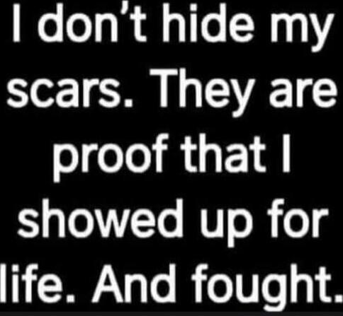 I don't hide my scars. They are proof that I showed up for life. And fought.