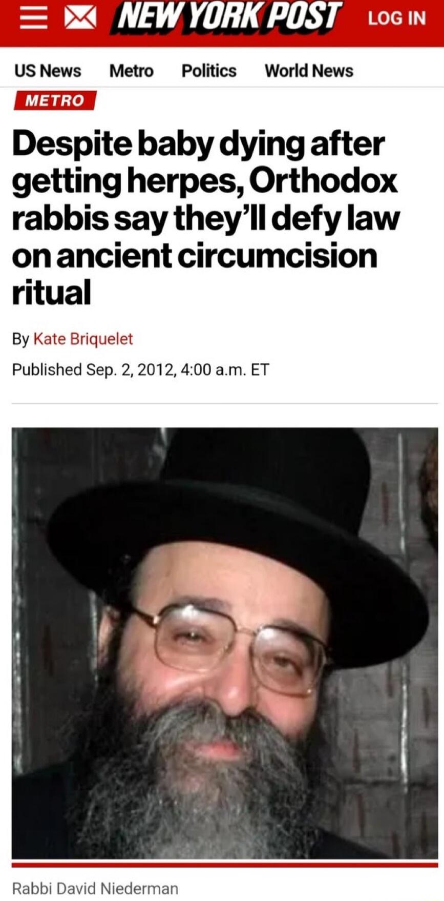 N A 1 A AT USNews Metro Politics World News Despite baby dying after getting herpes Orthodox rabbis say theyll defy law onancient circumcision ritual By Kate Briquelet Published Sep 22012 400 am ET
