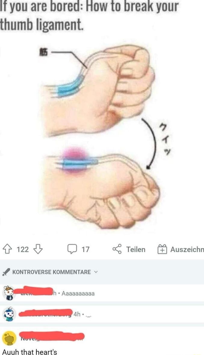 IT you are bored How o break your thumb ligament P Q7 o Teilen Auszeichn KONTROVERSE KOMMENTARE B 200000000 aom _ T Auuh that hearts