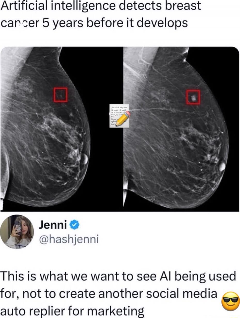 Artificial intelligence detects breast cancer 5 years before it develops

This is what we want to see AI being used for, not to create another social media auto replier for marketing