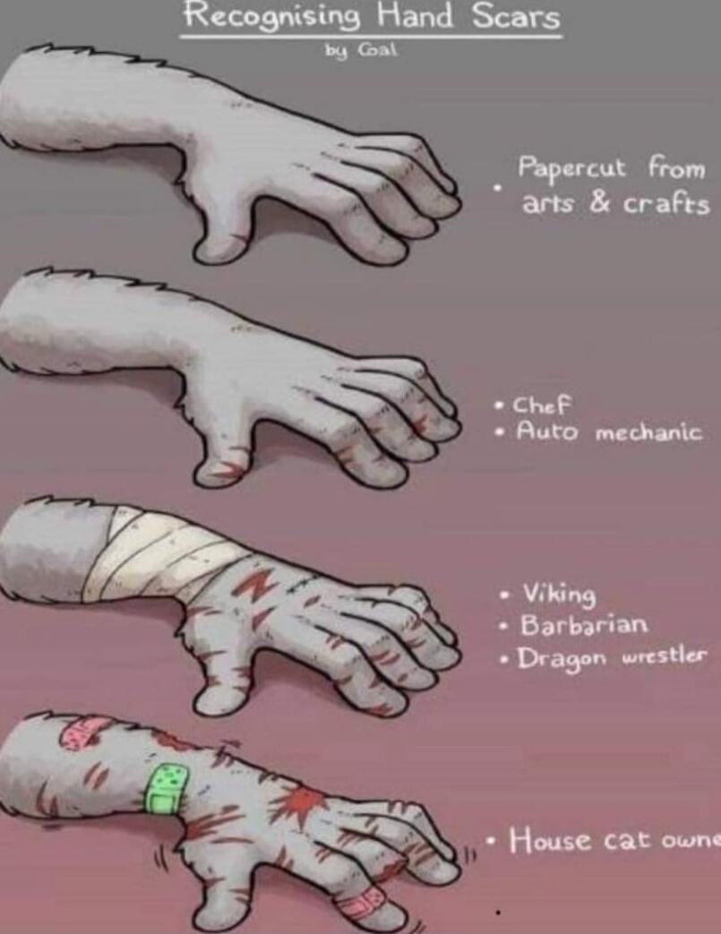 Recognising Hand Scars
by Goal
• Paper cut from acts & crafts
• Chef
• Auto mechanic
• Viking
• Barbarian
• Dragon wrestler
• House cat owner