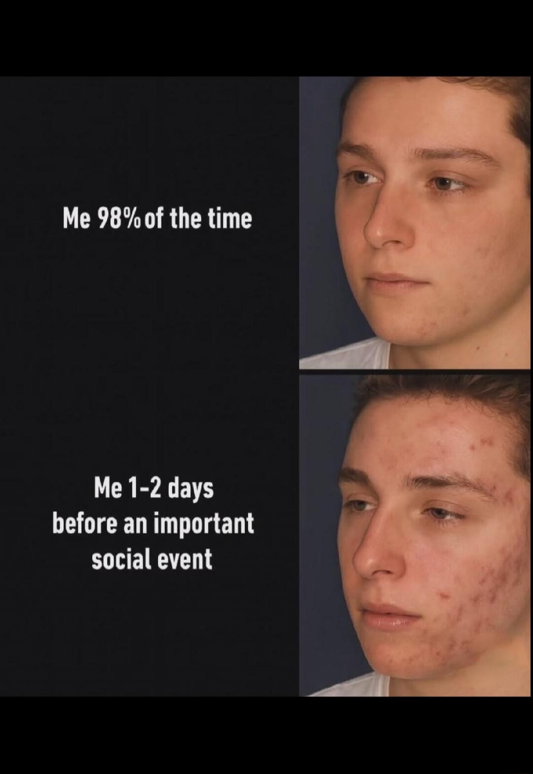 Me 98% of the time
Me 1-2 days before an important social event