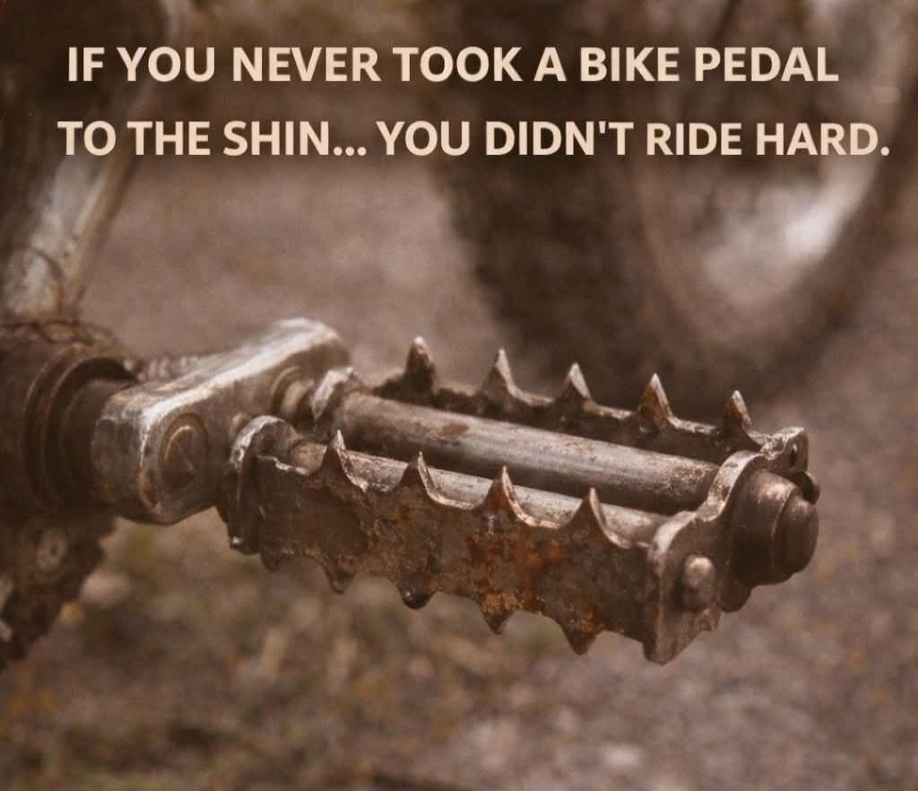 IF YOU NEVER TOOK A BIKE PEDAL TO THE SHIN... YOU DIDN'T RIDE HARD.