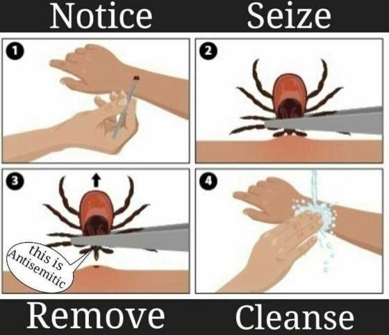 ing A Remove G CEN R