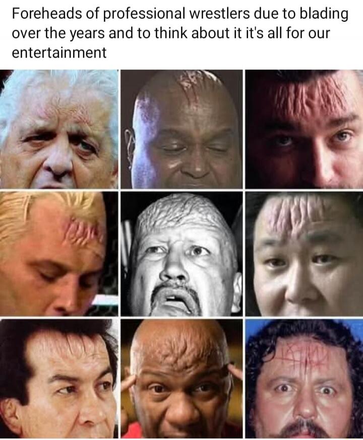 Foreheads of professional wrestlers due to blading over the years and to think about it it's all for our entertainment
