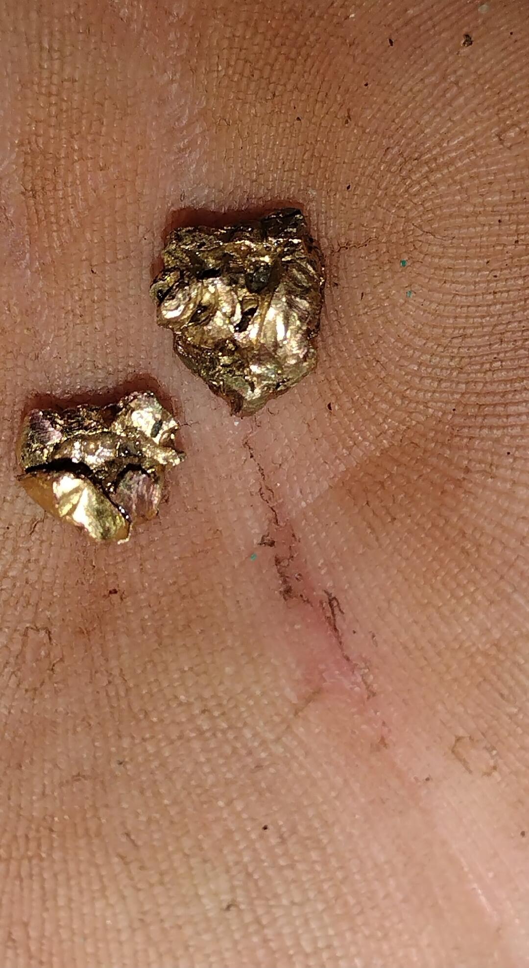 Two small gold-colored nuggets resting on skin.