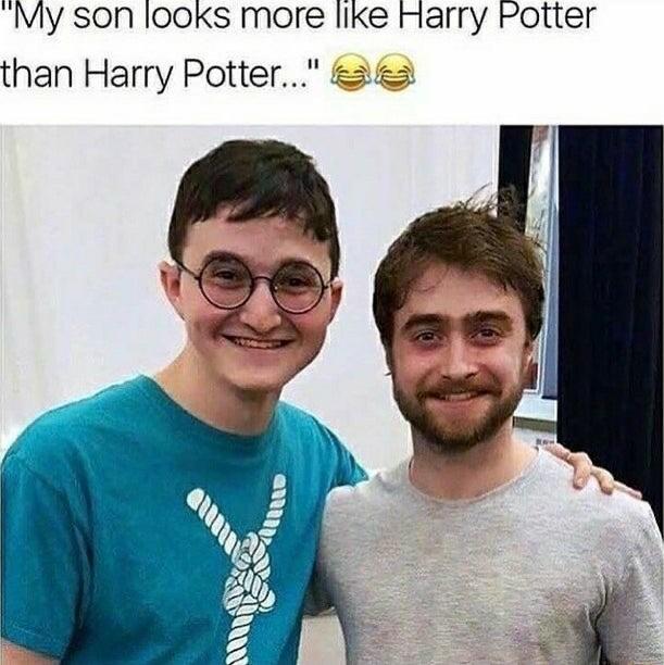 My son I00Ks more like Harry Potter than Harry Potter