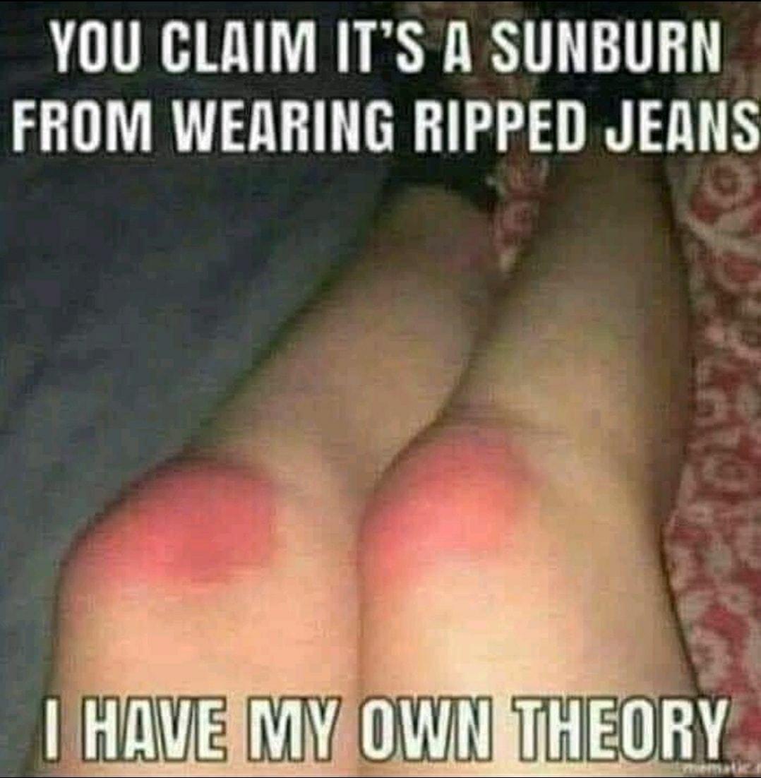 YOU CLAIM ITS A SUNBURN FROM WEARING RIPPED JEANS