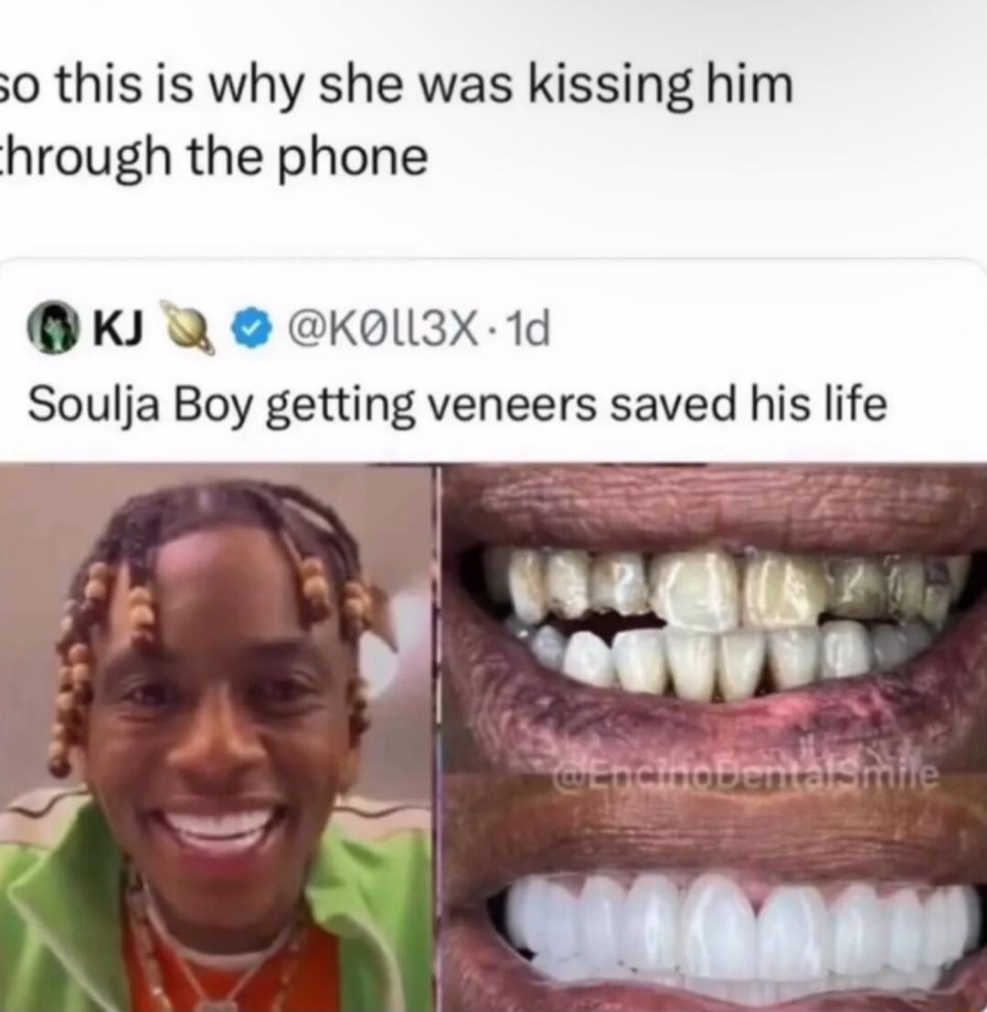 0 this is why she was kissing him hrough the phone B K Q KolsXx 1d Soulja Boy getting veneers saved his life