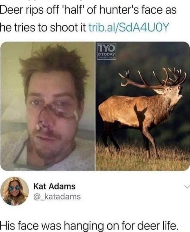 Deer rips off half of hunters face as e tries to shoot it tribal Kat Adams _katadams n for deer life