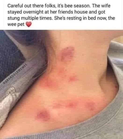 Careful out there folks its bee season The wife stayed overnight at her friends house and got stung multiple times Shes resting in bed now the wee pet