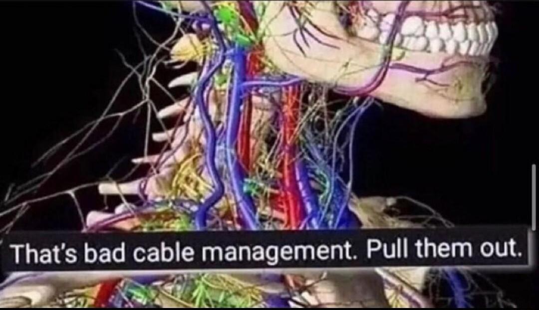 Thats bad cable management Pull them out R