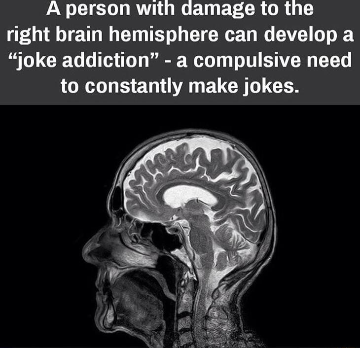 A person with damage to the LT ET G TN TR ETCRE G G T L TVE S joke addiction a compulsive need LR ET AN ECCE UGN