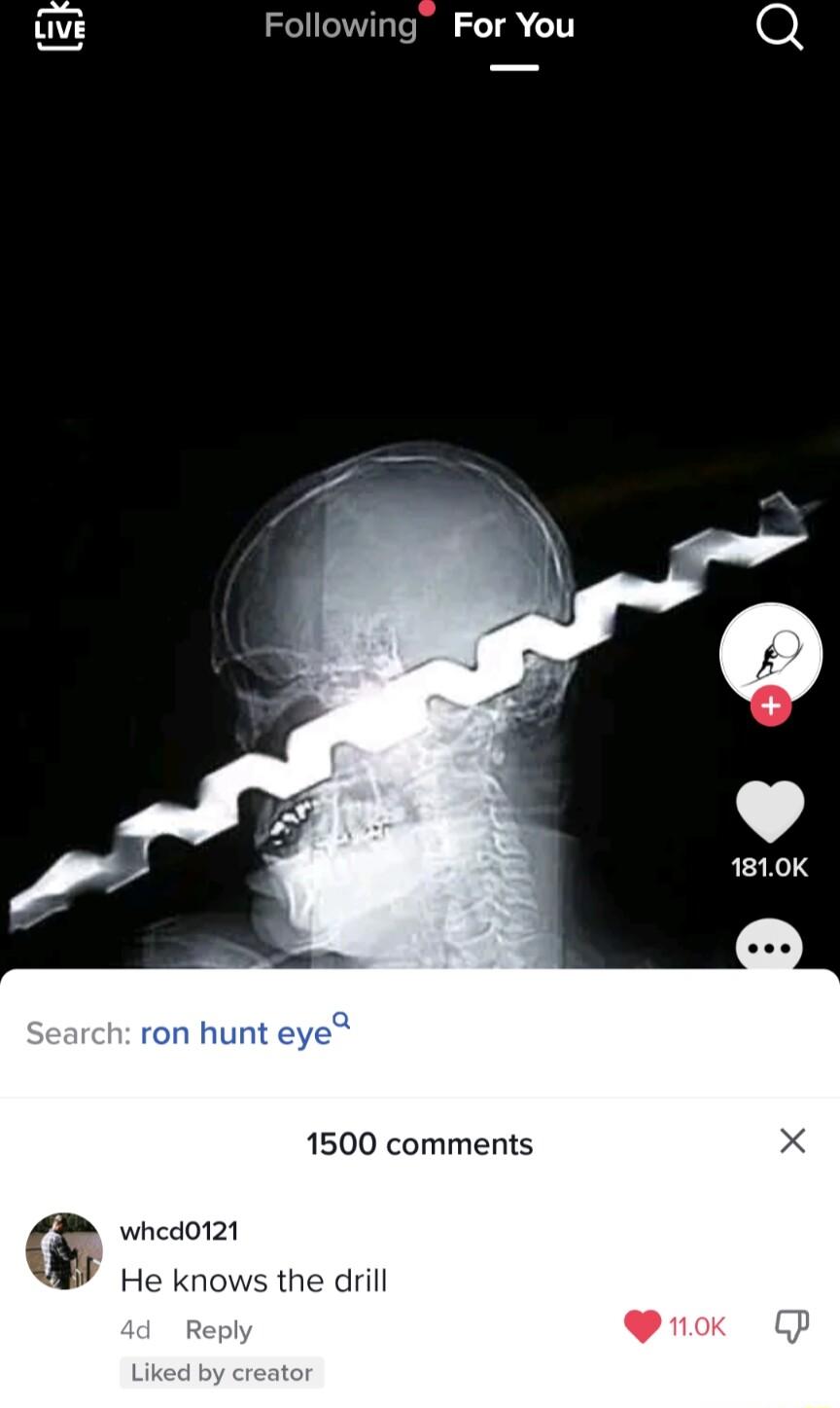 Following For You ron hunt eye 1500 comments whed0121 Y