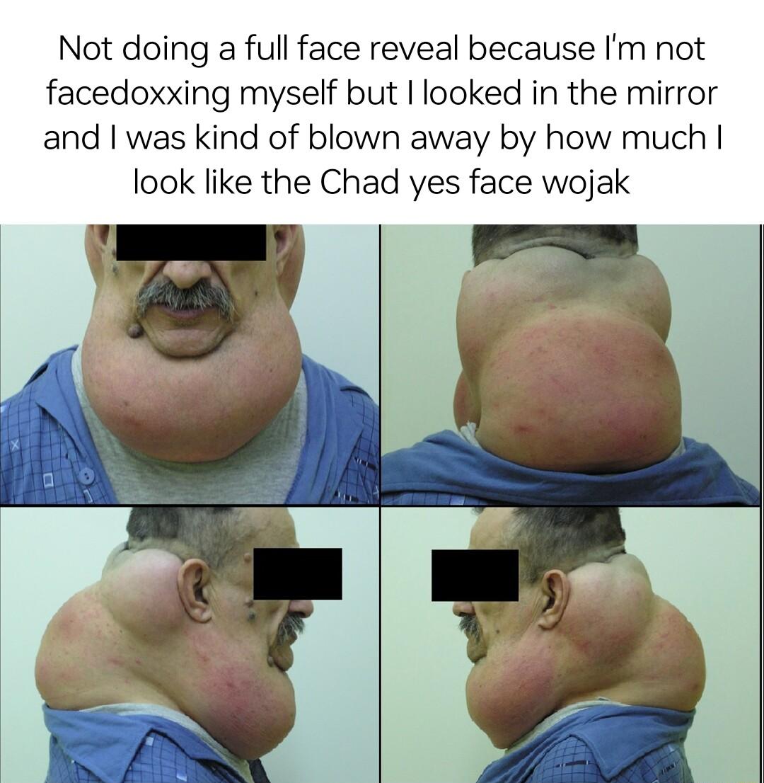 Not doing a full face reveal because Im not facedoxxing myself but looked in the mirror and was kind of blown away by how much look like the Chad yes face wojak