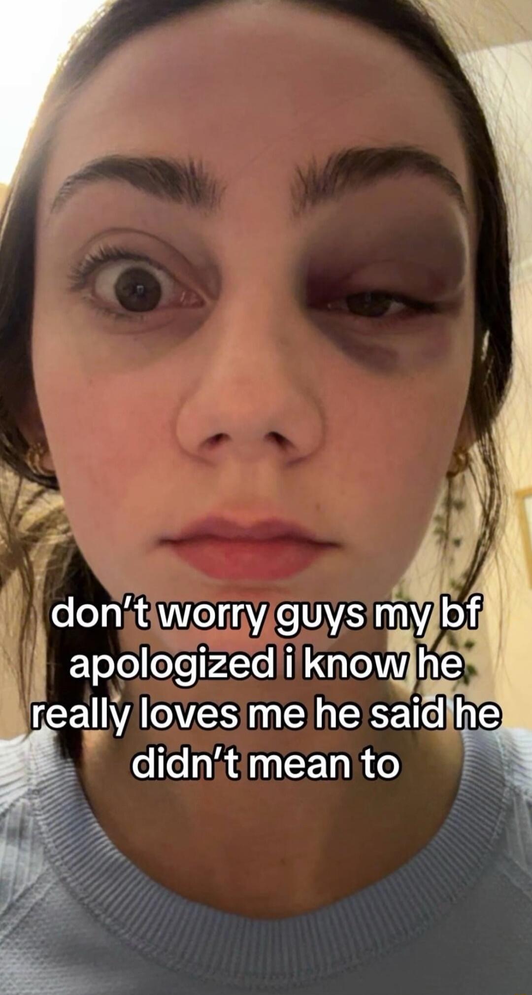 W dont WOrmYguys m reaIrIV VESEEEE TR 3 didnitmeanto
