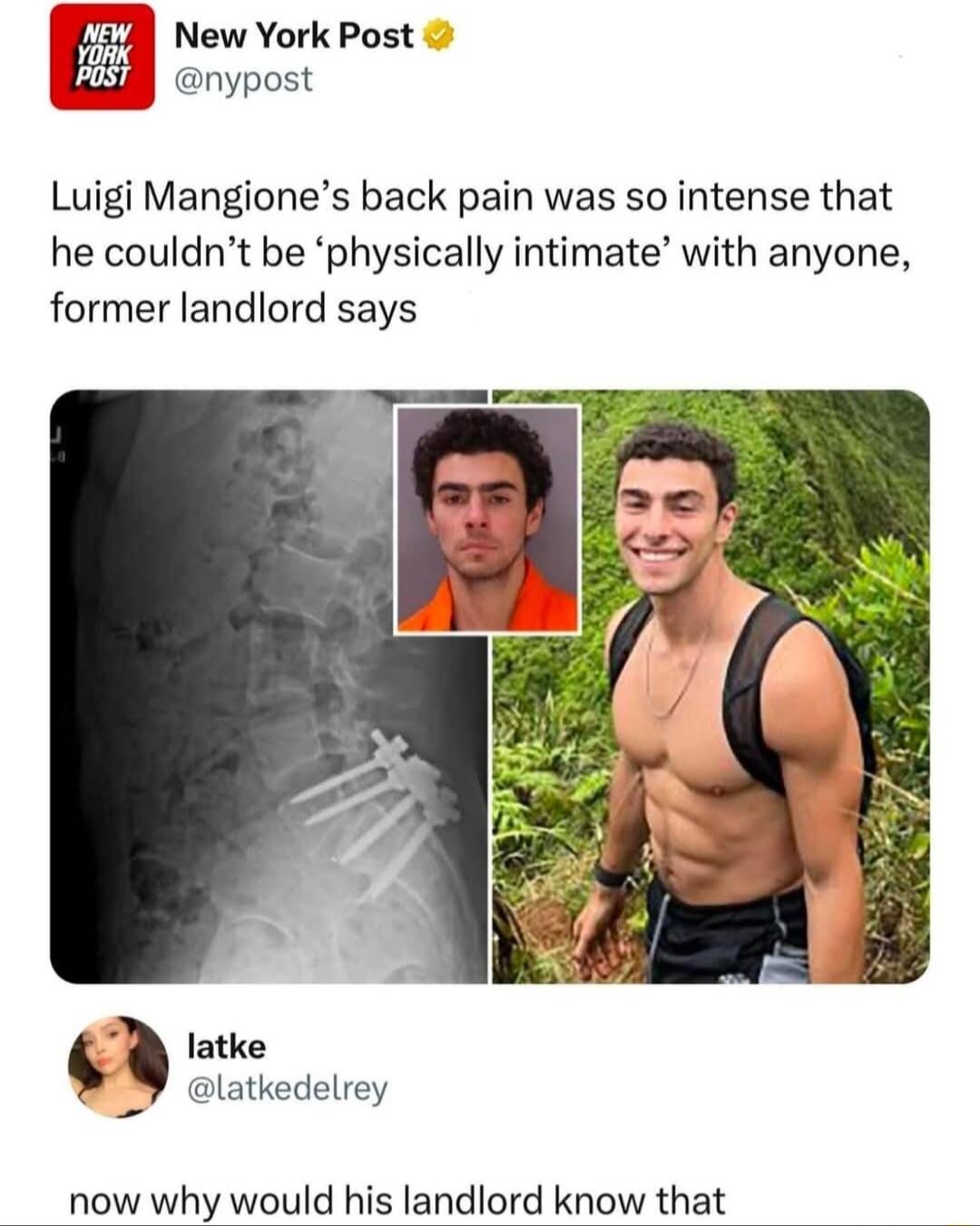 Luigi Mangiones back pain was so intense that he couldnt be physically intimate with anyone former landlord says New York Post nypost latke latkedelrey now why would his landlord know that