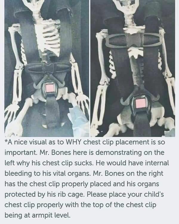 i b o A nice visual as to WHY chest clip placement is so important Mr Bones here is demonstrating on the left why his chest clip sucks He would have internal bleeding to his vital organs Mr Bones on the right has the chest clip properly placed and his organs protected by his rib cage Please place your childs chest clip properly with the top of the chest clip being at armpit level