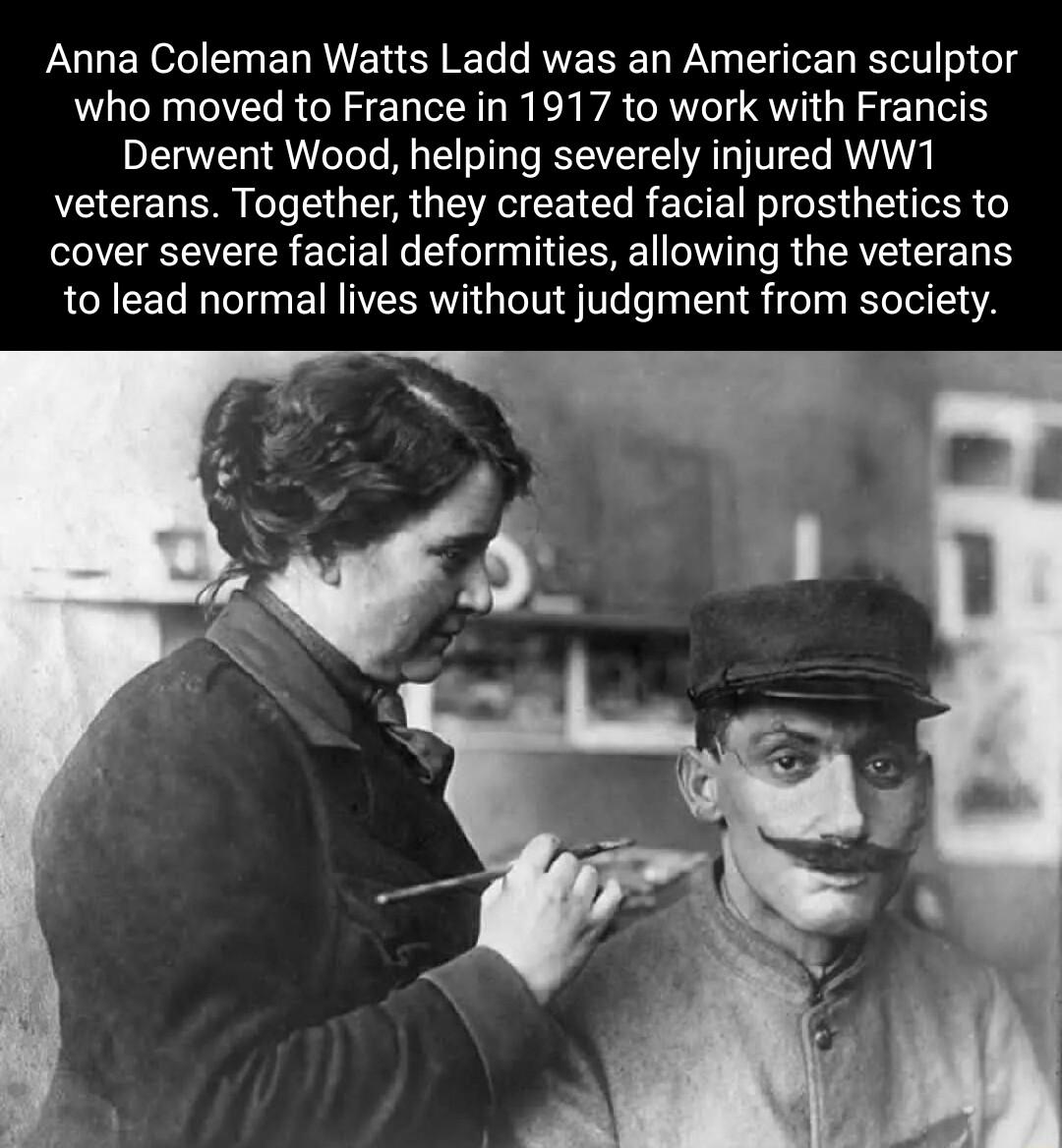 Anna Coleman Watts Ladd was an American sculptor who moved to France in 1917 to work with Francis Derwent Wood helping severely injured WW1 veterans Together they created facial prosthetics to R EEE N B ERE TR R GEAE EEL to lead normal lives without judgment from society