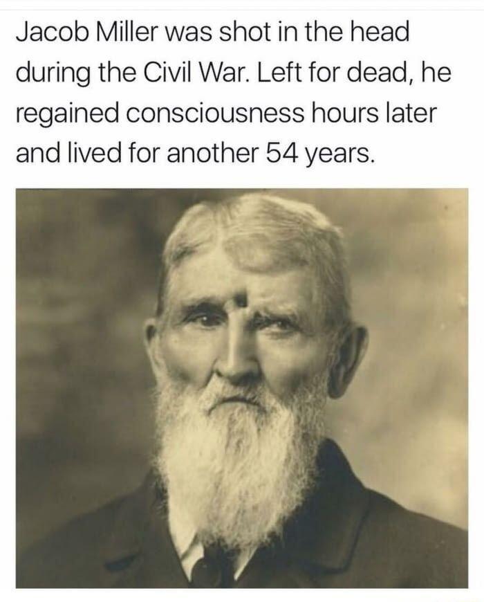 Jacob Miller was shot in the head during the Civil War Left for dead he regained consciousness hours later and lived for another 54 years