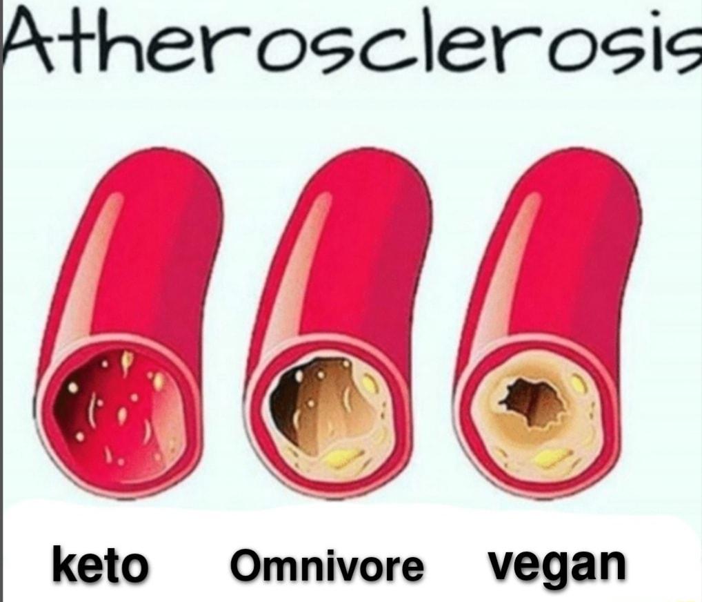 therosclerosic Bl g 6 l keto Omnivore vegan