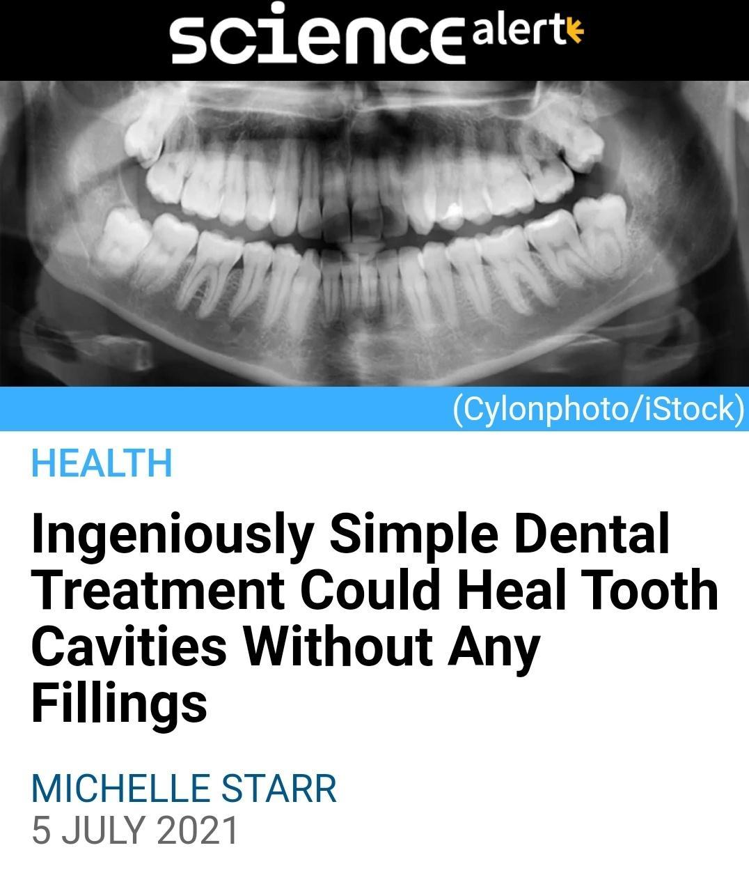 JealTp o Lhg Ingeniously Simple Dental Treatment Could Heal Tooth Cavities Without Any Fillings MICHELLE STARR 5 JULY 2021