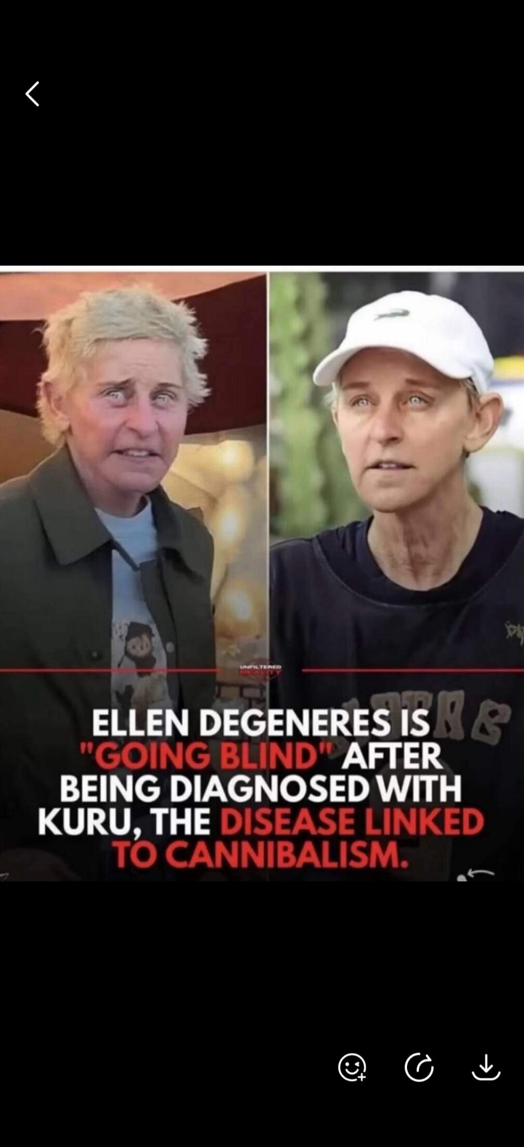 Ellen DeGeneres is 'going blind' after being diagnosed with Kuru, the disease linked to cannibalism. Unfiltered Reality.