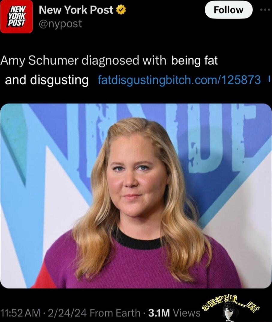 New York Post Amy Schumer diagnosed with being fat and disgusting fatdisgustingbitchcom125873