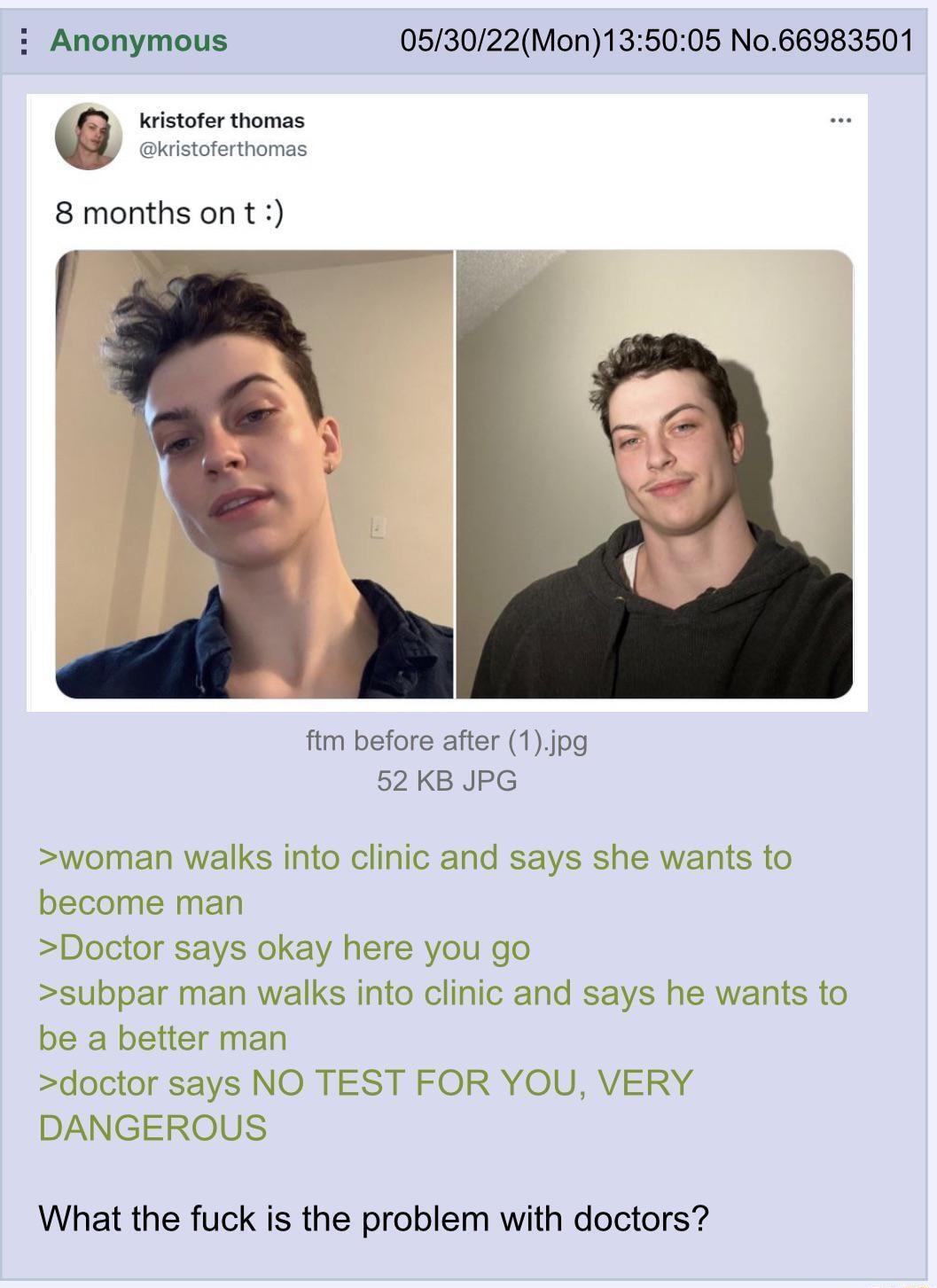 i Anonymous 053022Mon135005 No66983501 kristofer thomas kristoferthomas 8 monthsont ftm before after 1jpg 52 KB JPG woman walks into clinic and says she wants to become man Doctor says okay here you go subpar man walks into clinic and says he wants to be a better man doctor says NO TEST FOR YOU VERY DANGEROUS What the fuck is the problem with doctors