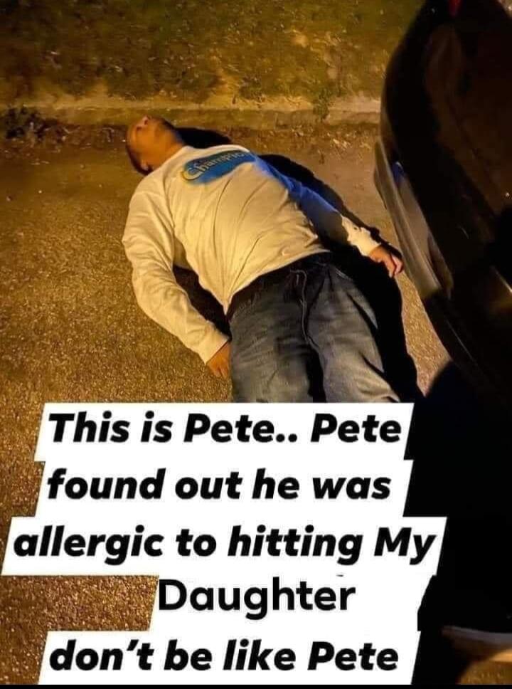 This is Pete Pet found out he was allergic to hitting My dont be like Pete