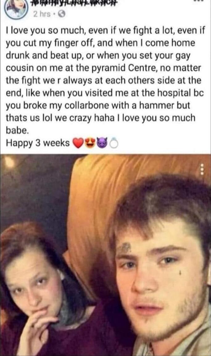 love you so much even if we fight a lot even if you cut my finger off and when come home drunk and beat up or when you set your gay cousin on me at the pyramid Centre no matter the fight we r always at each others side at the end like when you visited me at the hospital bc you broke my collarbone with a hammer but thats us lol we crazy haha love you so much babe Happy 3 weeks