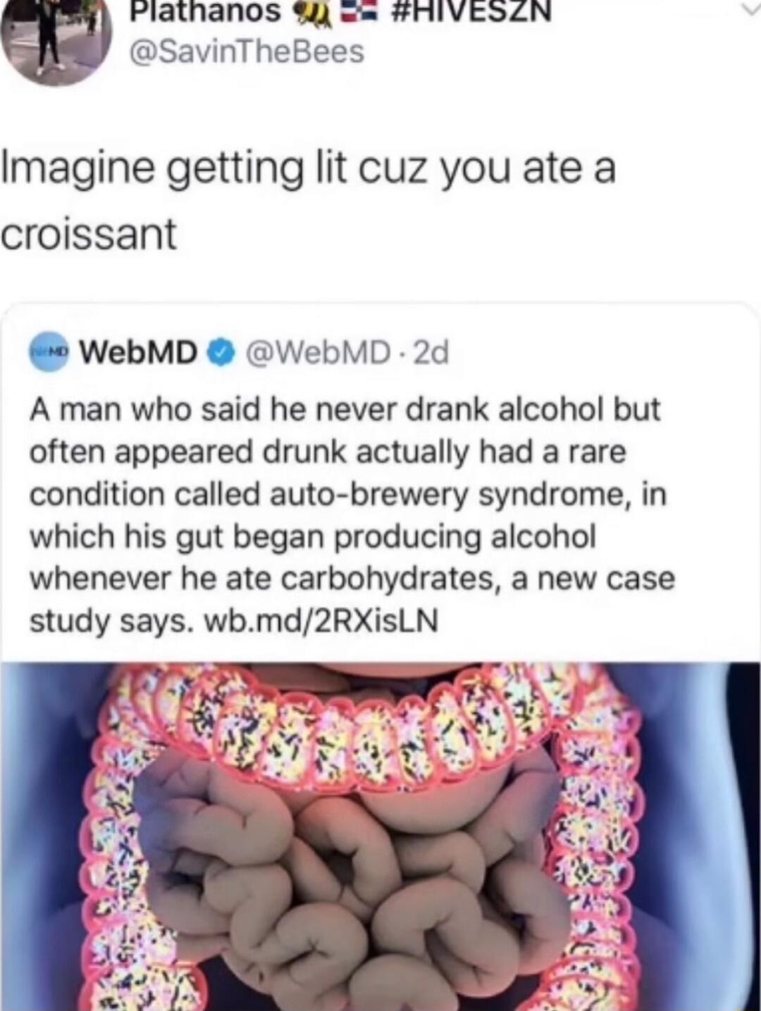 Flathanos HIVESLN SavinTheBees Imagine getting lit cuz you ate a croissant WebMD WebMD 2d A man who said he never drank alcohol but often appeared drunk actually had a rare condition called auto brewery syndrome in which his gut began producing alcohol whenever he ate carbohydrates a new case study says wbmd2RXisLN