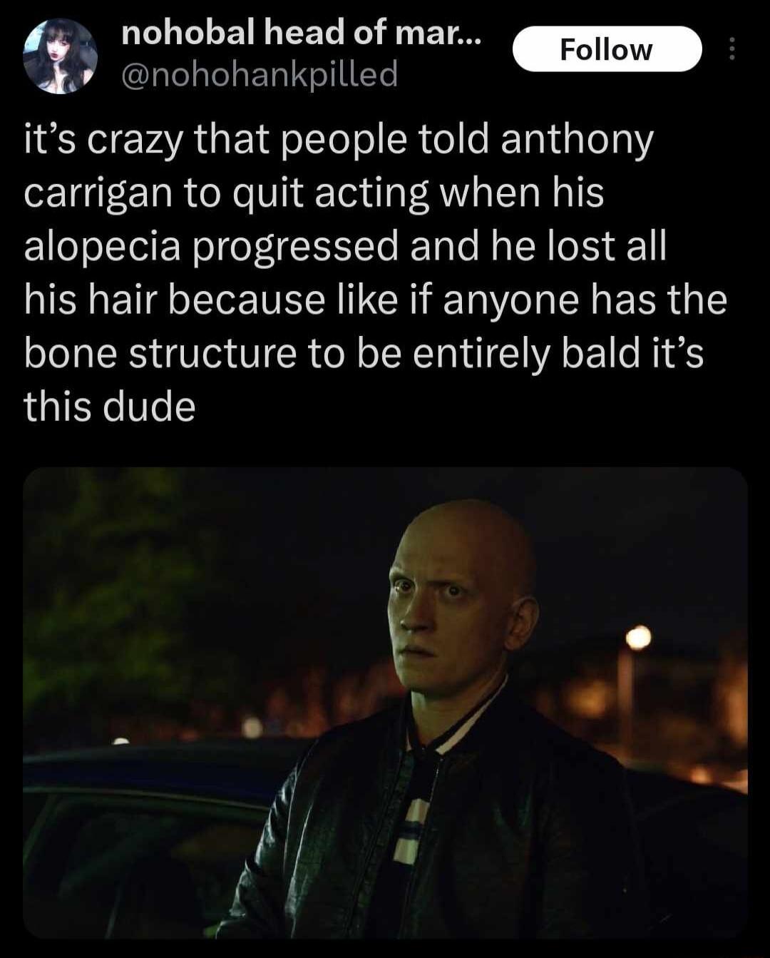 nohobal head of mar X nohohankpilled its crazy that people told anthony carrigan to quit acting when his alopecia progressed and he lost all his hair because like if anyone has the bone structure to be entirely bald its this dude