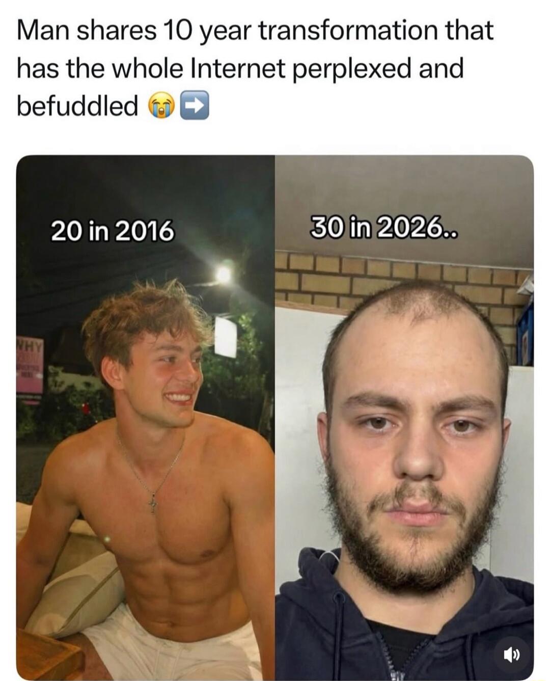Man shares 10 year transformation that has the whole Internet perplexed and befuddled 😭➡️
20 in 2016
30 in 2026..