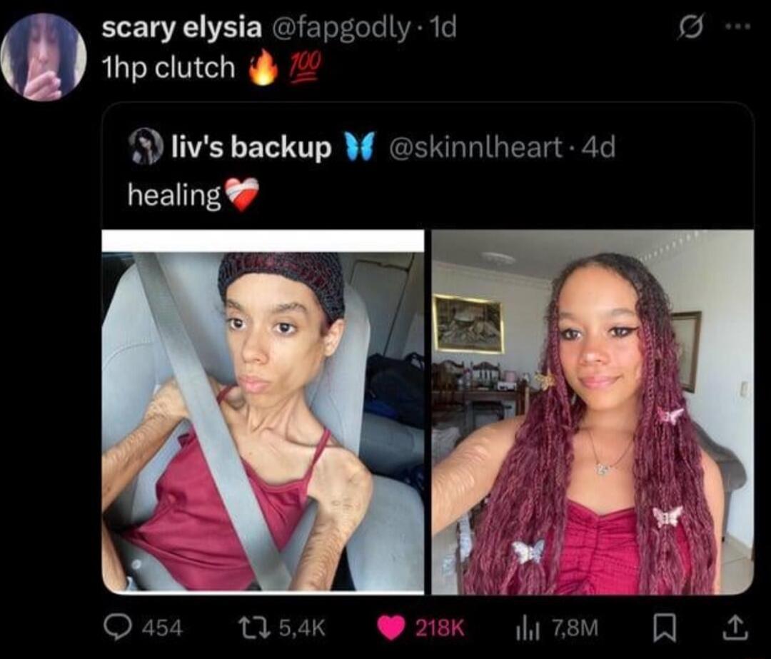 scary elysia @fapgoddy - 1d: 1hp clutch 🔥💯
liv's backup @skinllheart - 4d: healing ❤️