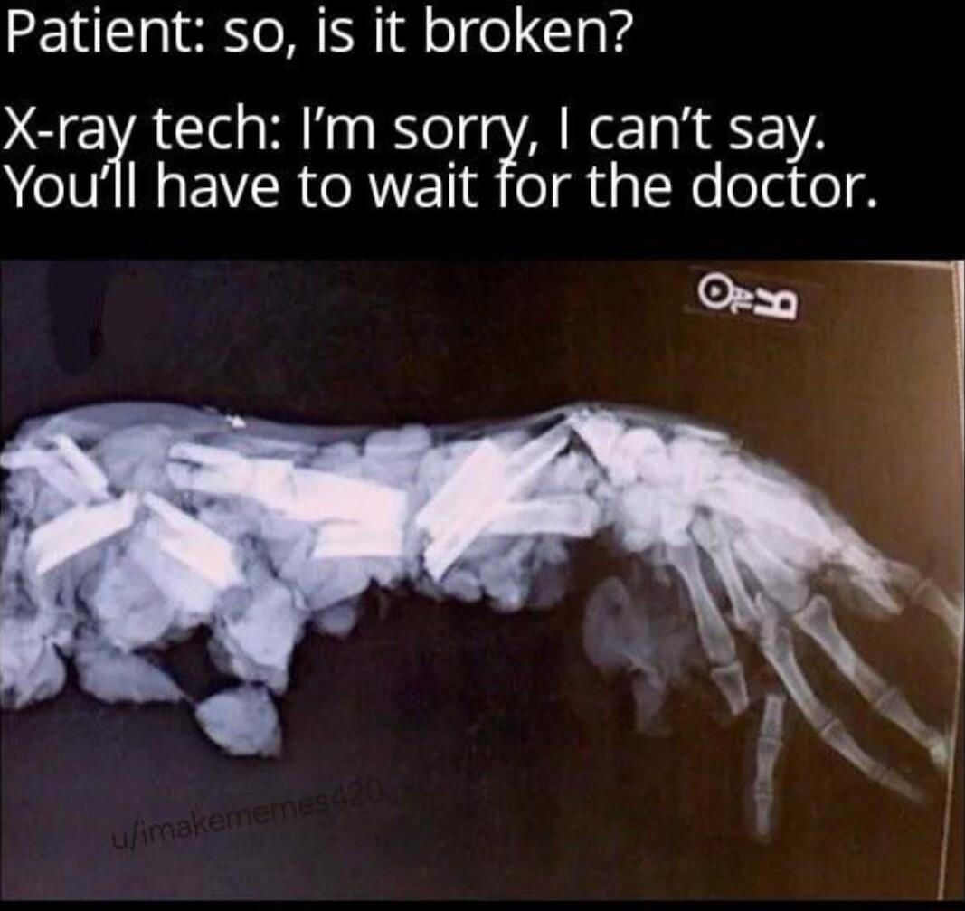 Patient so is it broken X ray tech Im sorry cant say NIV R EVIR ORVETI o i gTNo oui o