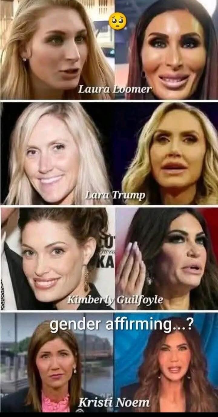 Laura Loomer Lara Trump Kimberly Guilfoyle Kristi Noem gender affirming...?