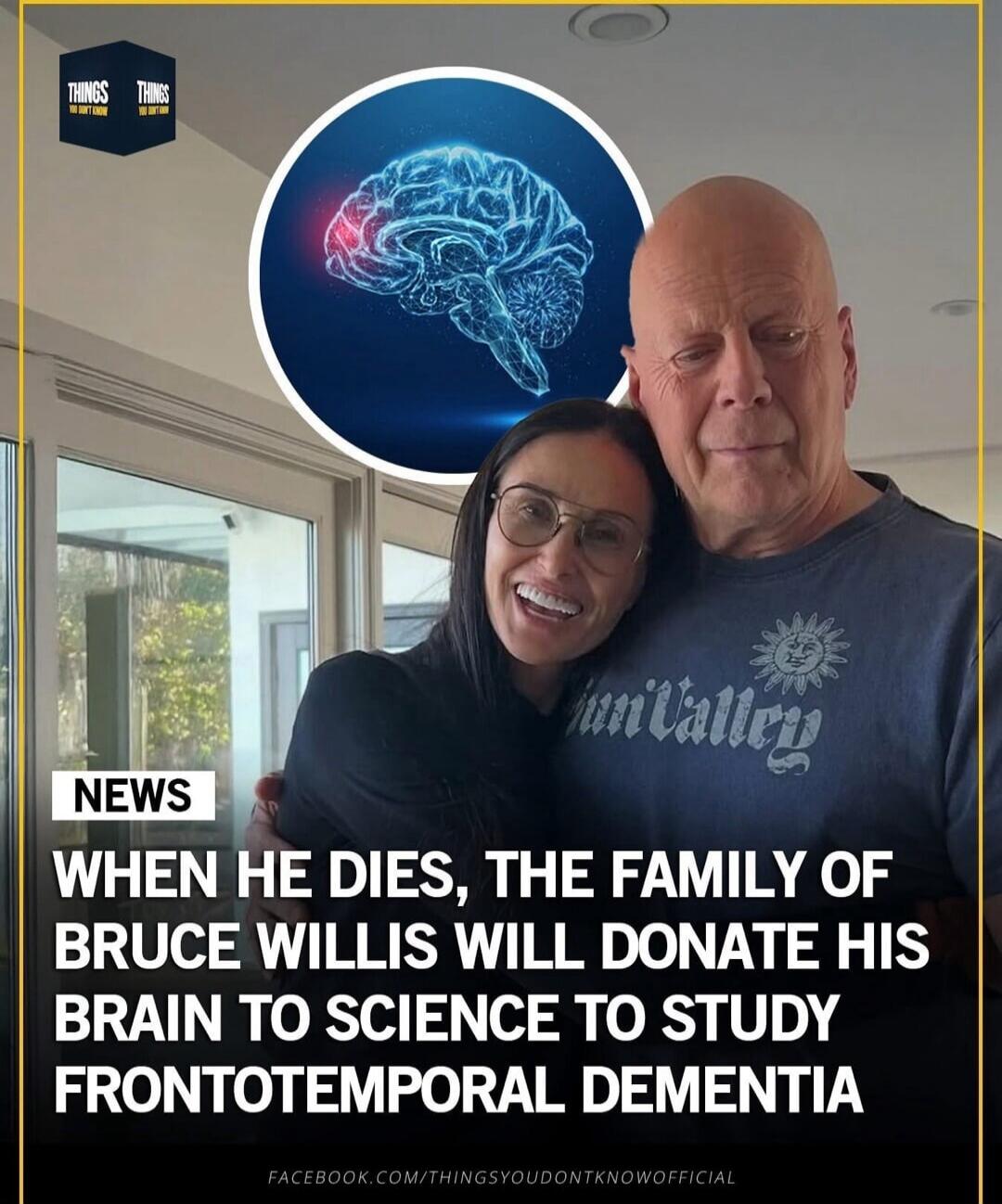 NEWS WHEN HE DIES, THE FAMILY OF BRUCE WILLIS WILL DONATE HIS BRAIN TO SCIENCE TO STUDY FRONTOTEMPORAL DEMENTIA