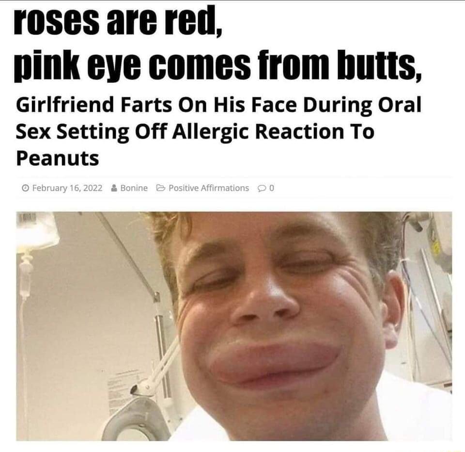 Girlfriend Farts On His Face During Oral Sex Setting Off Allergic Reaction To Peanuts February 162022 Bonine Positive Affirmations 0 T U o R