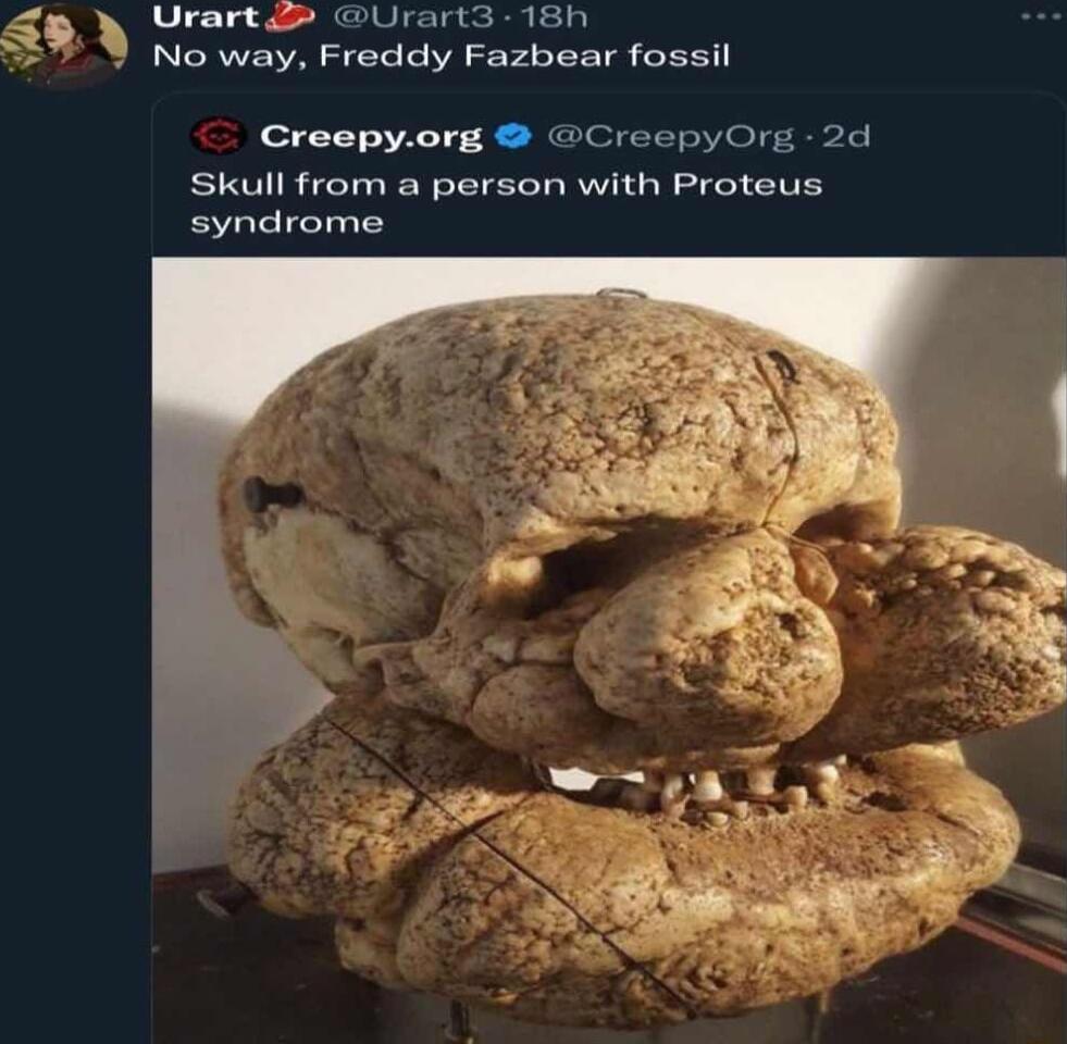 Y Urart Urart3 18h No way Freddy Fazbear fossil Creepyorg CreepyOrg 2d Skull from a person with Proteus syndrome
