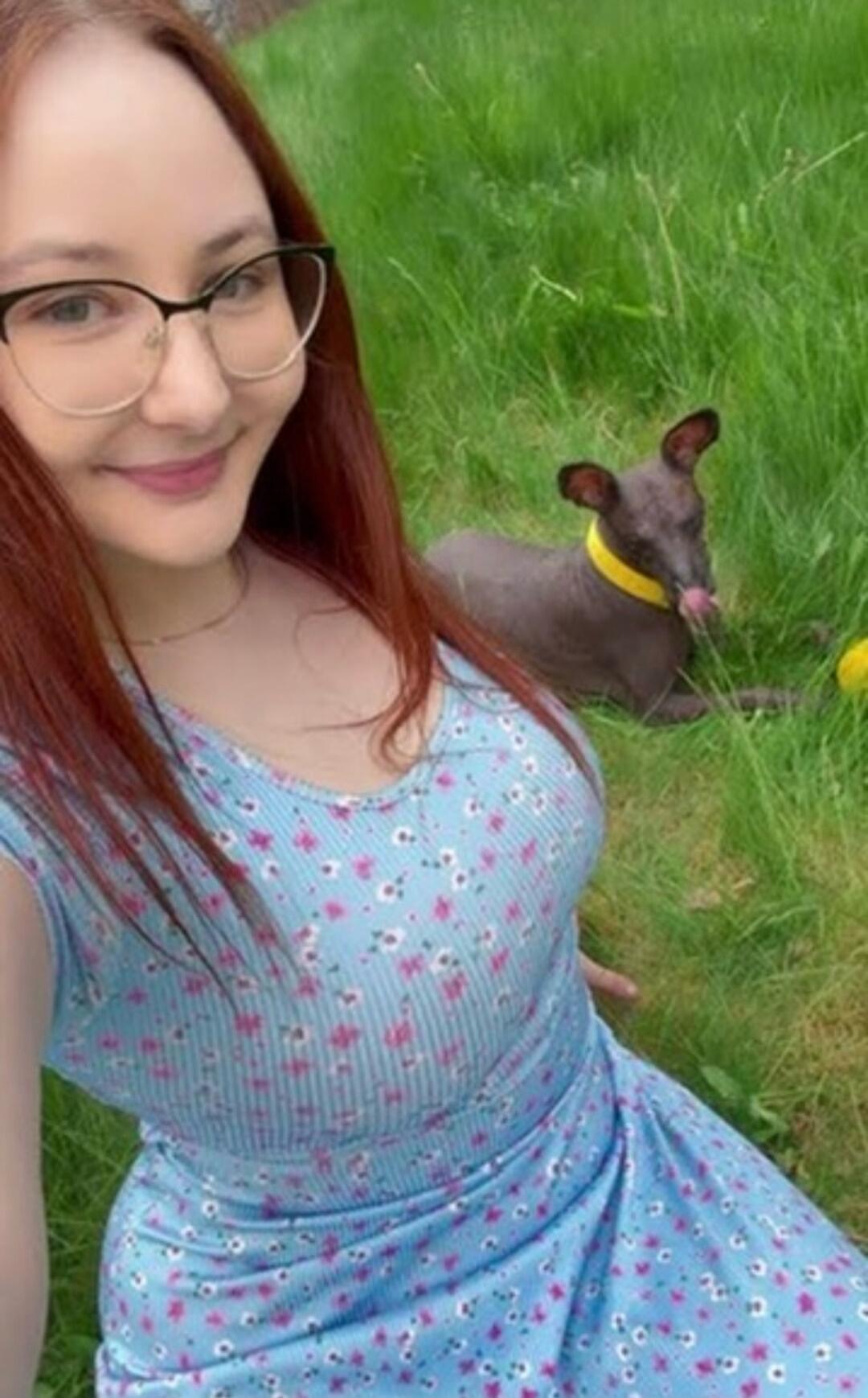 A woman with red hair and glasses takes a selfie with a hairless dog in the grass. The woman is wearing a light blue floral dress. The dog, wearing a yellow collar, is lying in the green grass and appears to be licking its nose.